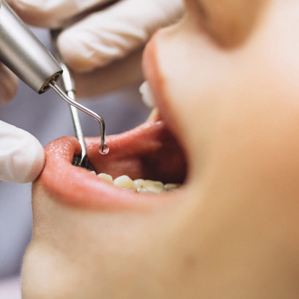 IMPLANTES DENTÁRIOS: Conheça todas as possibilidades desse tratamento