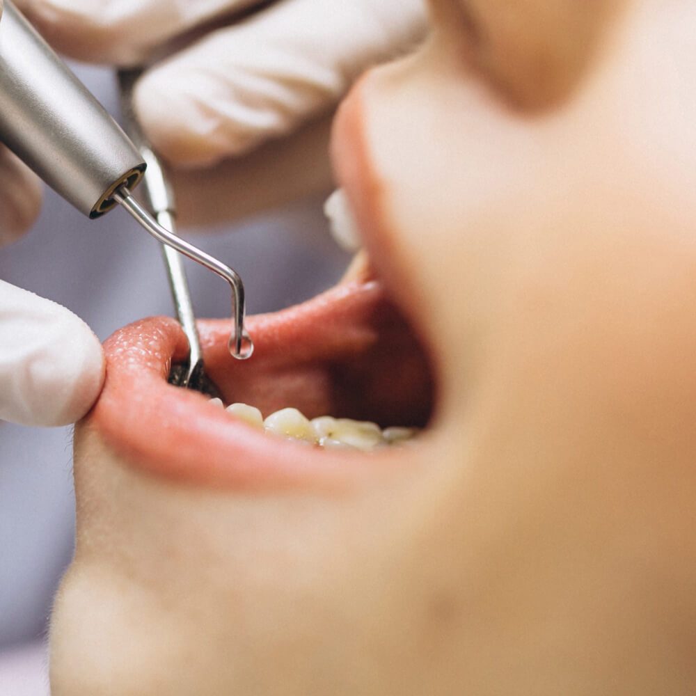 dentes e saude