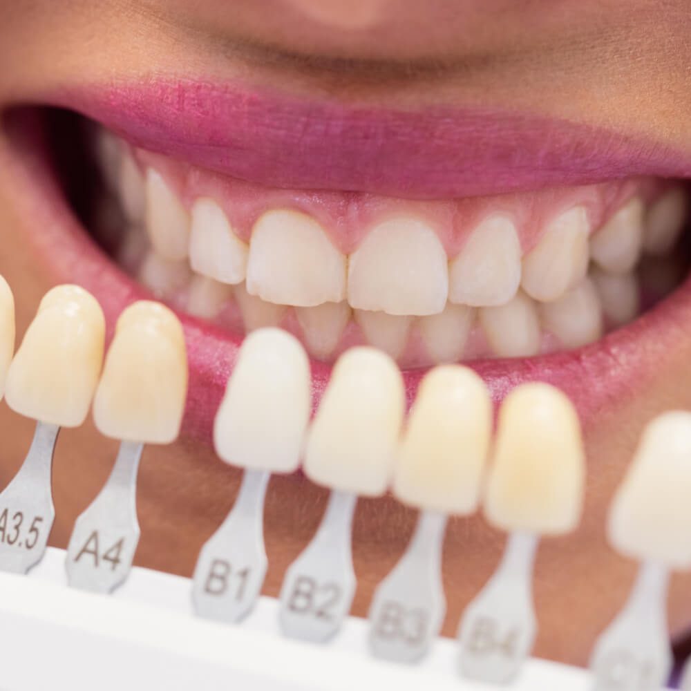 implante dentario